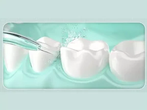 دستگاه شست و شوی دهان و دندان شیائومی Xiaomi Mijia Electric Oral Irrigation F300 MEO703 Dental Irrigator Teeth